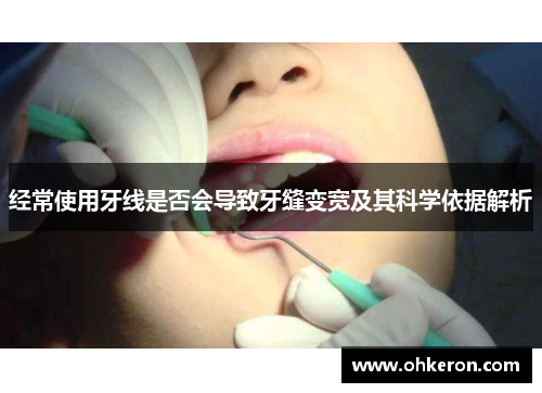 经常使用牙线是否会导致牙缝变宽及其科学依据解析